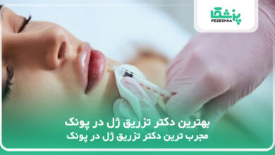بهترین دکتر تزریق ژل در پونک