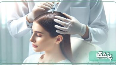 بهترین دکتر مزوتراپی مو در شهرک غرب