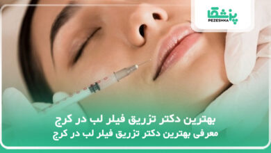 بهترین دکتر تزریق فیلر لب در کرج