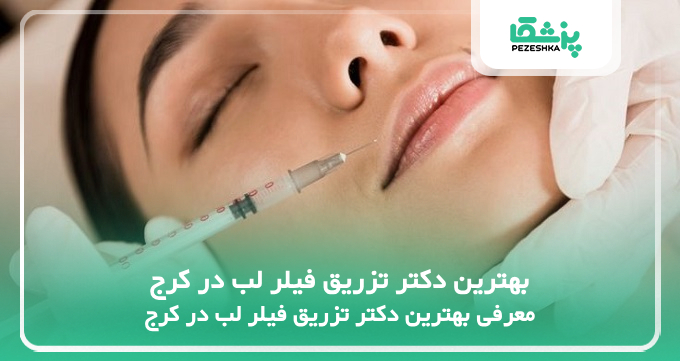 بهترین دکتر تزریق فیلر لب در کرج