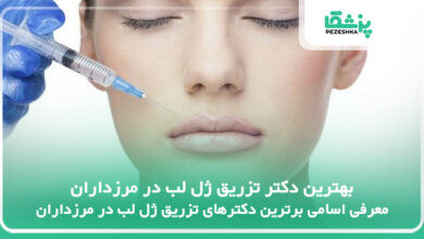 بهترین دکتر تزریق ژل لب در مرزداران