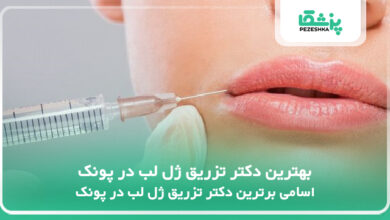 بهترین دکتر تزریق ژل لب در پونک
