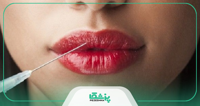 مراحل گام به گام تزریق ژل لب