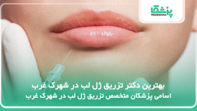 بهترین دکتر تزریق ژل لب در شهرک غرب