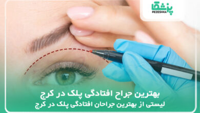 10 تا از بهترین جراح افتادگی پلک در کرج