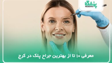 بهترین جراح پلک در کرج