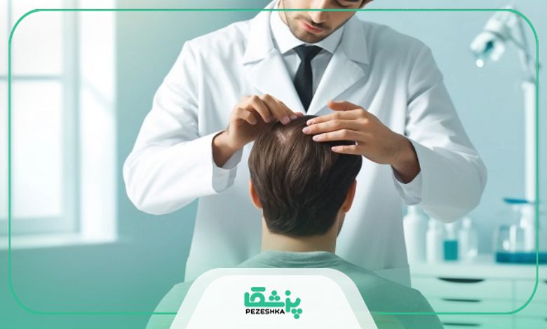 معیارهای انتخاب بهترین دکتر درمان ریزش مو در کرج