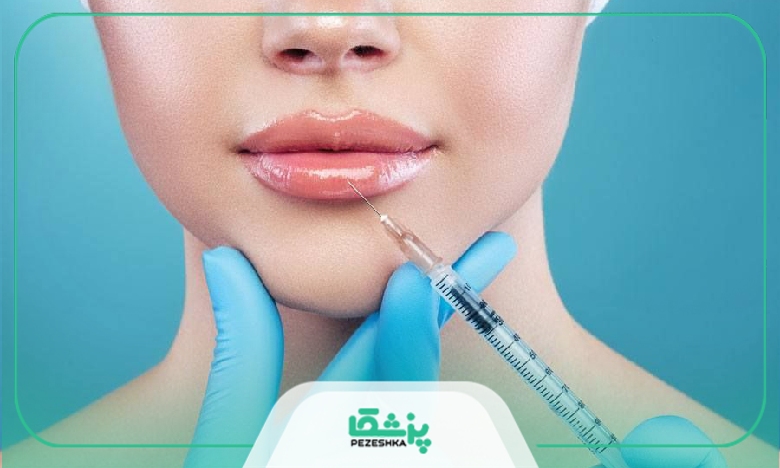 مدل های مختلف تزریق فیلر لب طبیعی با سایربرند ها