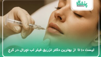 10 تا از بهترین دکتر تزریق فیلر لب نچرال در کرج