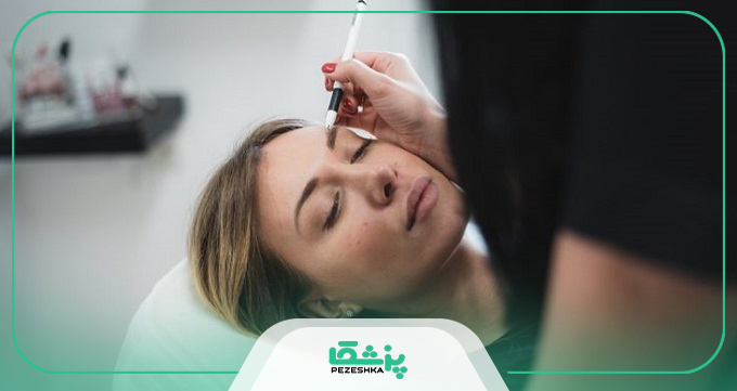 مراحل انجام کاشت ابرو طبیعی