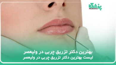 بهترین دکتر تزریق چربی در ولیعصر