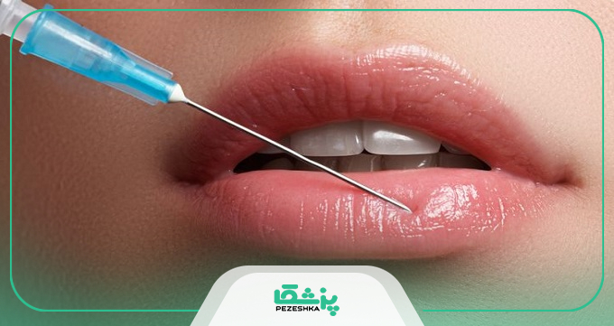 بهترین دکتر تزریق فیلر در اندیشه کیست؟