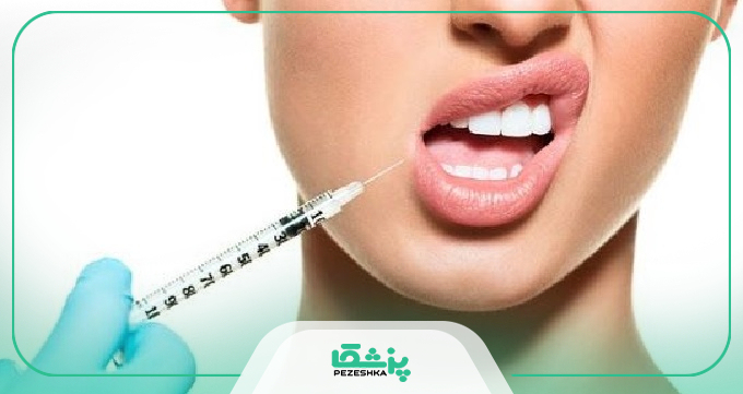 توصیه های مراقبتی بهترین دکتر تزریق ژل در مهرویلا