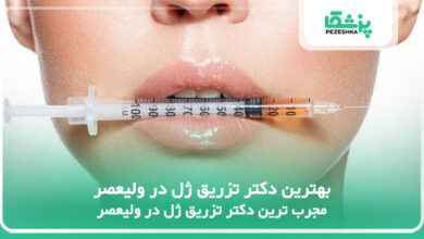 بهترین دکتر تزریق ژل در ولیعصر