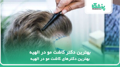 بهترین دکتر کاشت مو در الهیه