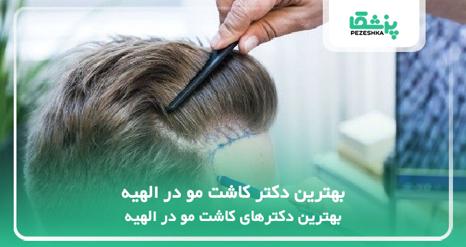 بهترین دکتر کاشت مو در الهیه