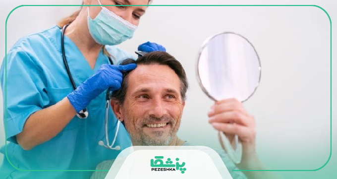عوامل موثر در ماندگاری کاشت مو