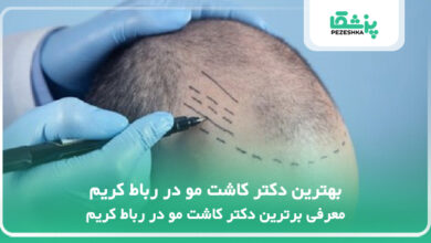 بهترین دکتر کاشت مو در رباط کریم