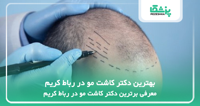 بهترین دکتر کاشت مو در رباط کریم