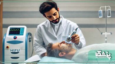 بهترین دکتر هایفوتراپی در الهیه