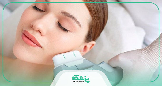 نکات لیزر موهای زائد