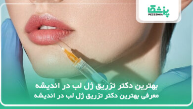 بهترین دکتر تزریق ژل لب در اندیشه