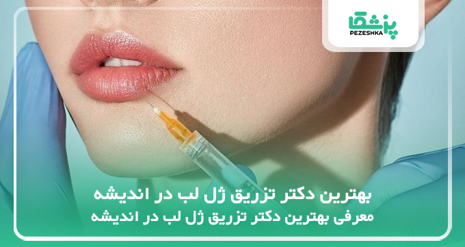 بهترین دکتر تزریق ژل لب در اندیشه