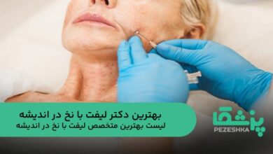 بهترین دکتر لیفت با نخ در اندیشه
