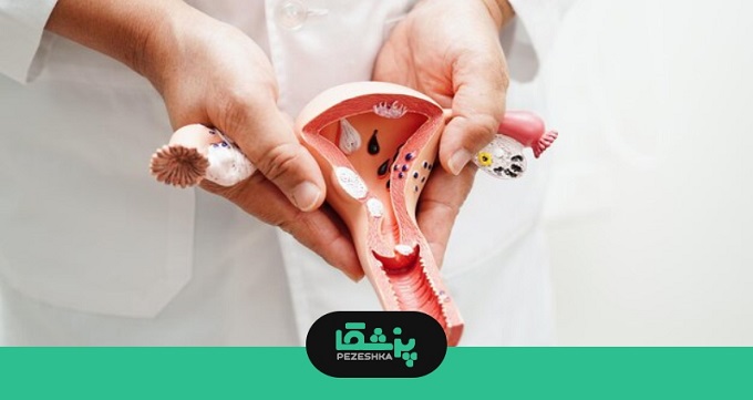 توصیه های پیشگیرانه بهترین دکتر زگیل تناسلی در رباط کریم