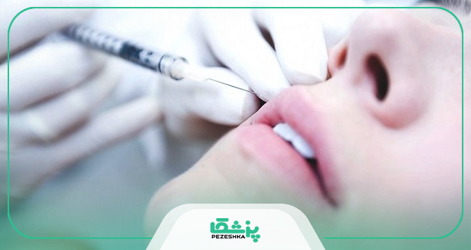 مزایای مراجعه و دریافت نوبت از بهترین دکتر تزریق چربی در اندیشه