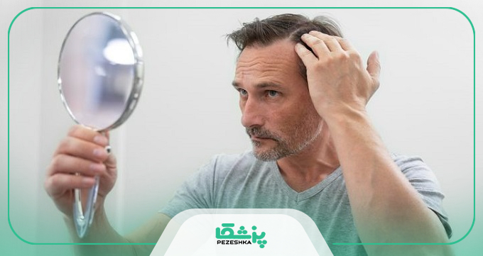توصیه‌های کلیدی بهترین دکتر کاشت مو اندیشه به مراجعین خود