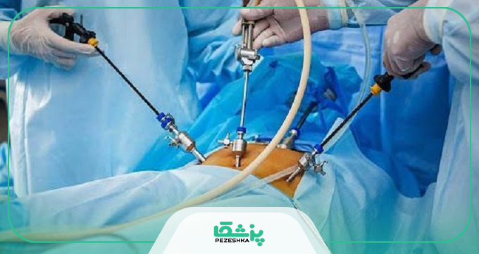 علائمی که نشان می‌دهد، باید به بهترین دکتر جراح لاپاراسکوپی مراجعه کنید؟