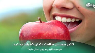 تاثیر سیب بر سلامت دندان