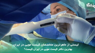 بهترین دکتر کیست مویی در ایران