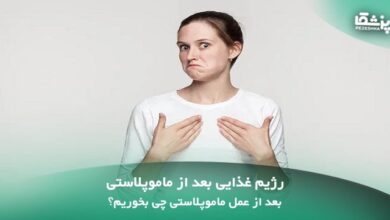 رژیم غذایی بعد از ماموپلاستی