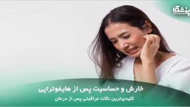 خارش و حساسیت پس از هایفوتراپی