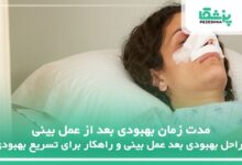 مدت زمان بهبودی بعد از عمل بینی