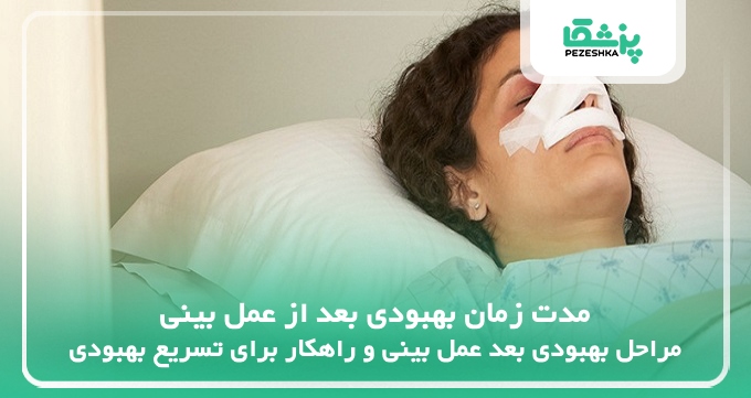 مدت زمان بهبودی بعد از عمل بینی