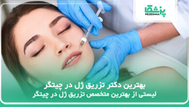 بهترین دکتر تزریق ژل در چیتگر