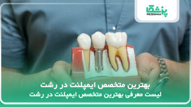 بهترین متخصص ایمپلنت در رشت