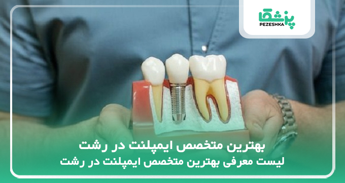 بهترین متخصص ایمپلنت در رشت