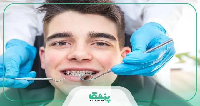 انواع ارتودنسی دندان: بهترین گزینه برای شما