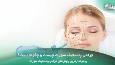 جراحی پلاستیک صورت چیست و چگونه است؟