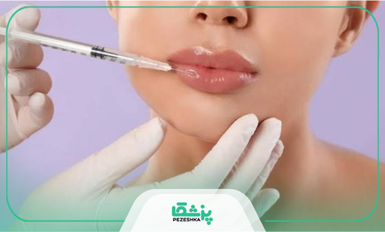 بهترین دکتر تزریق ژل در تهرانسر چه ویژگیهایی دارد؟