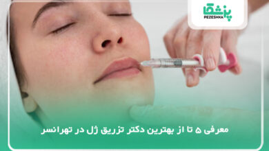 بهترین دکتر تزریق ژل در تهرانسر