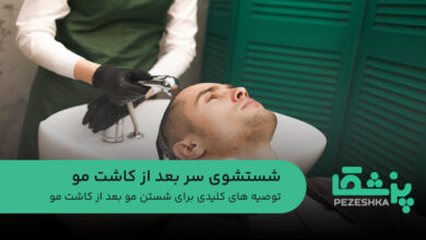 شستشوی سر بعد از کاشت مو