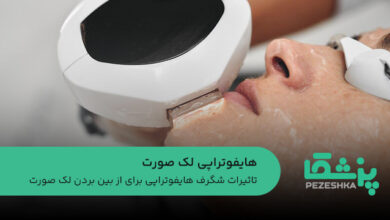 هایفوتراپی لک صورت