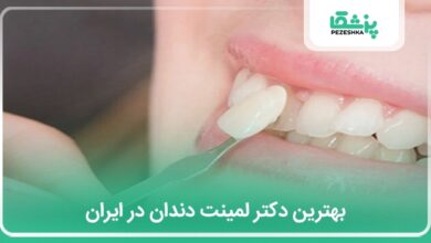 بهترین دکتر لمینت دندان در ایران