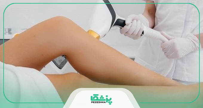 چه کسانی می توانند به بهترین کلینیک لیزر موهای زائد در چیتگر مراجعه کنند؟