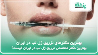 بهترین دکترهای تزریق ژل لب در ایران